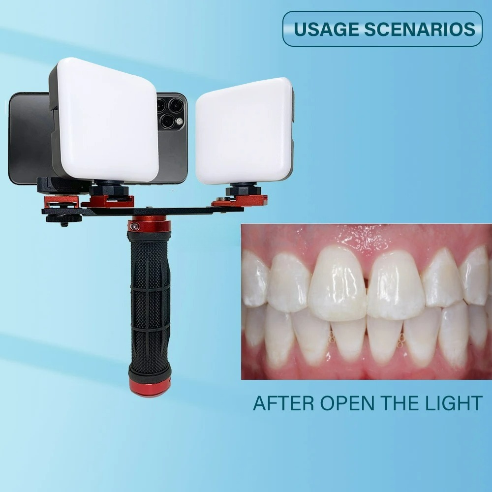 Lampa do fotografii stomatolog – Phone Accessories For Photography recenzja i cena